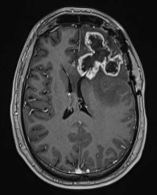 MRI Imagery